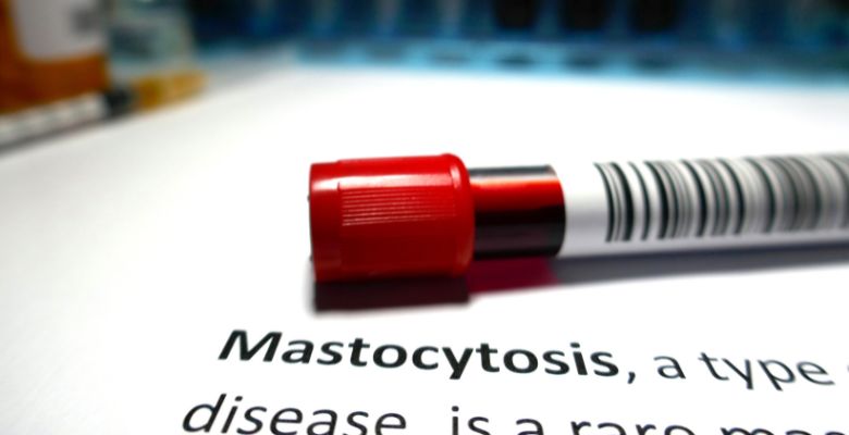 Mastocitoses: doenças raras que exigem maior sensibilização e diagnóstico precoce