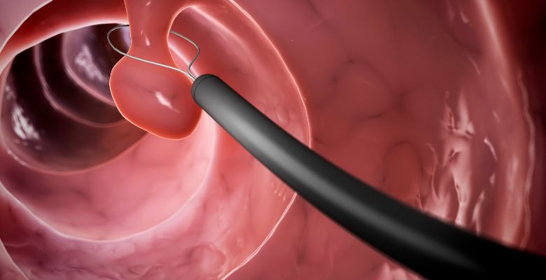 União Europeia aprova nova opção terapêutica para doentes com rinossinusite crónica com pólipos nasais